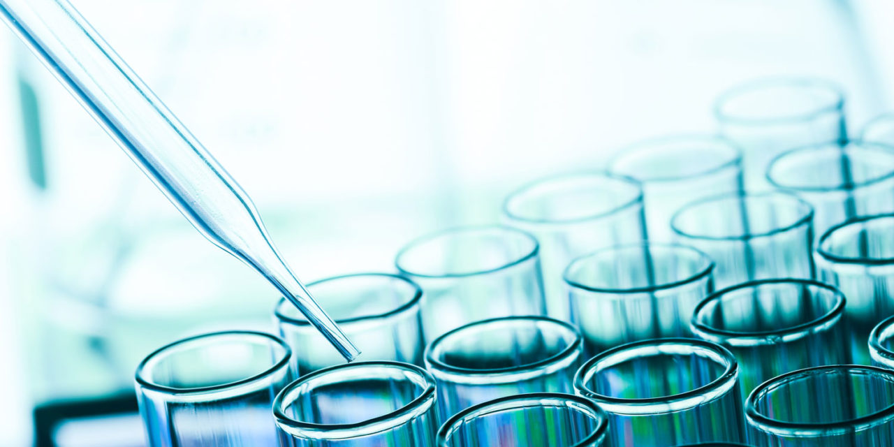 How to start with a program to improve your QC laboratory performance