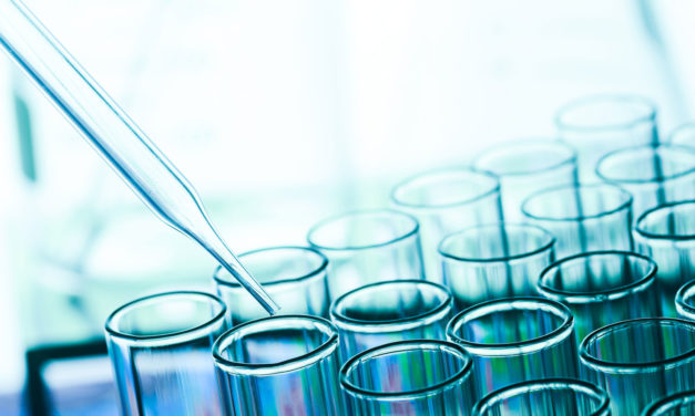 How to start with a program to improve your QC laboratory performance